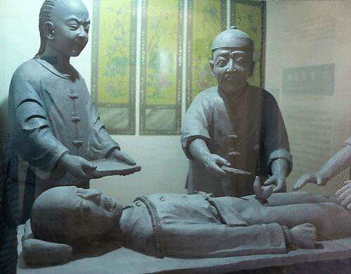 太监净身流程太监净身割哪里