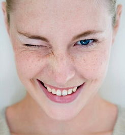 麻子脸图片,麻子脸的男人面相_竞价网