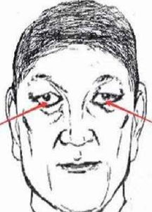 男人下三白眼不能嫁下三白眼男人能嫁吗