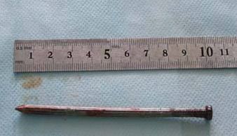 十公分多少厘米是多长十公分多少厘米是多长大约哪个手指的长度