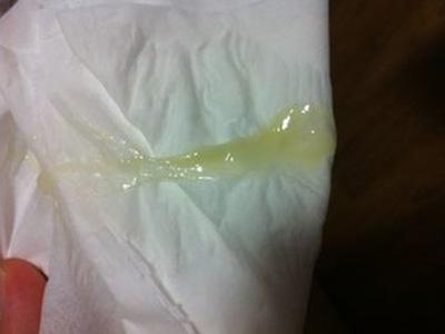 女生来白带说明什么