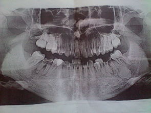 臼齿怎么读臼齿怎么读什么意思