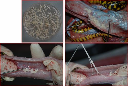 寄生虫感染的症状