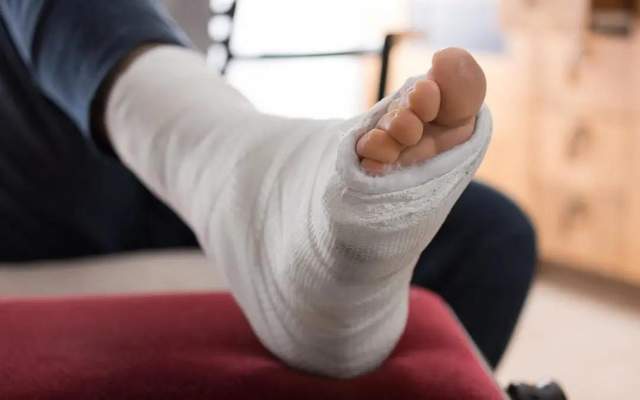 石膏固定以后要注意以1878年willatt首先报道1例因使用髋人字石膏后