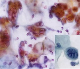 螨虫怎么去除简单方法