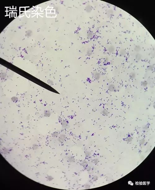 白带加德纳菌图片