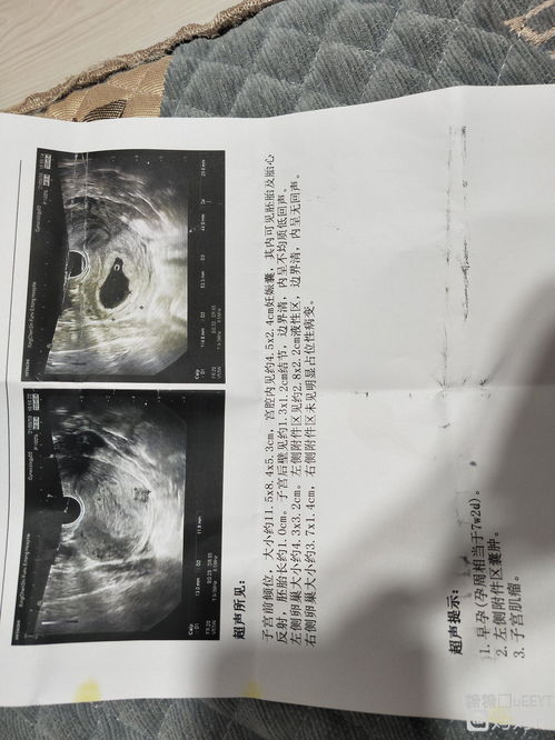 第一次的时候应该怎么做?