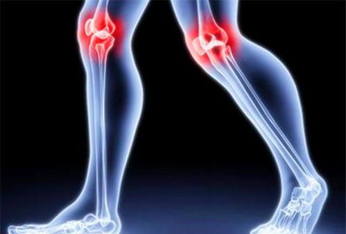 如关节囊比较松弛,周围的韧带比较薄弱,这种情况下关节就