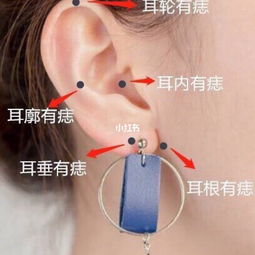 耳朵上长痣代表什么耳朵上长痣代表什么图解