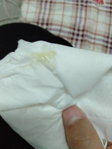 健康生活,女性分泌物都有啥作用?