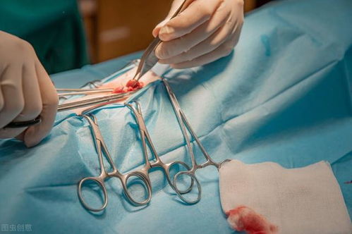 女人结扎是否老得快?