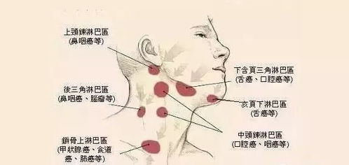 淋巴结在哪个位置图片图片