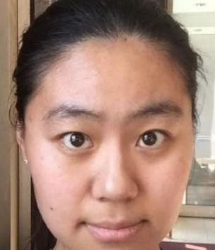 脑门大代表什么