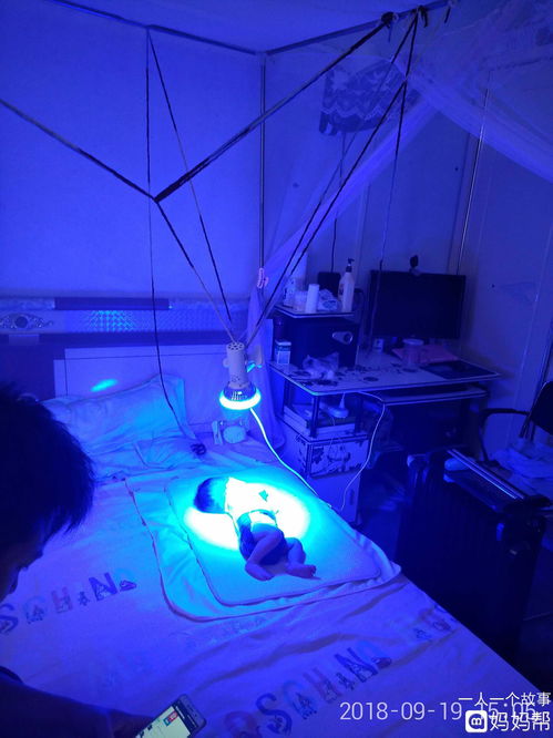 婴儿的大便次数会增多,而且颜色也会变成黄绿色,所以在婴儿照蓝光期间