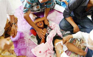 非洲割礼(非洲割礼是什么)