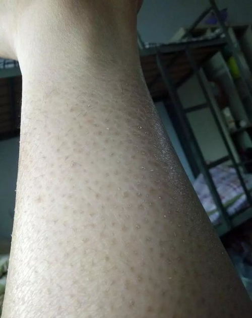 包含鸡皮肤是什么相机参数介绍的词条
