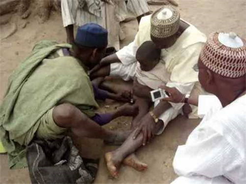 在非洲什么是割礼