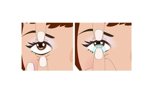 隐形眼镜戴反了是什么感觉隐形眼镜戴反了是什么感觉反了能看清吗