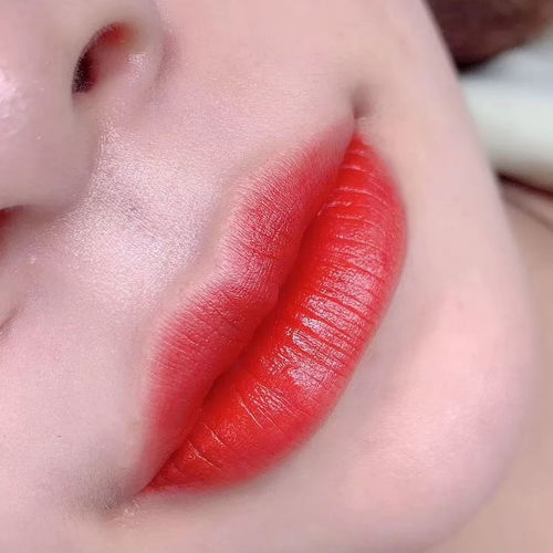 纹嘴唇后应注意什么