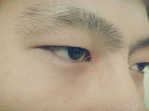 这个小孔叫做泪点,泪腺分泌的泪液借瞬间眼活动涂抹于眼球表面,多余的