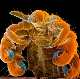 得了阴虱会传染给小孩吗,男人长阴虱会传染给小孩吗