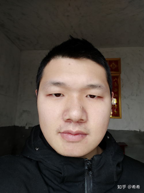 鼻子大的男人说明什么鼻子大怎么改善