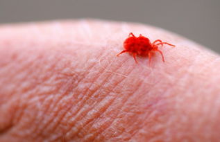 螨虫是什么样子的照片螨虫是什么颜色的