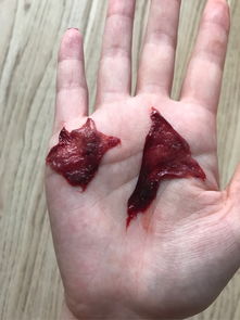 月经血里有血块,是怎么回事?