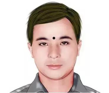 去除山根横纹的方法