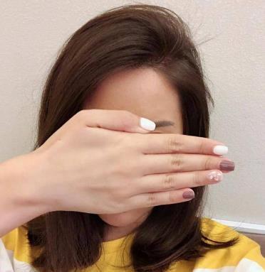 头发总是油腻是什么原因