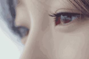 杭州双眼皮手术