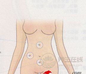 拔火罐拔哪个部位能减肥