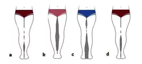 o型腿怎么矫正带有用吗