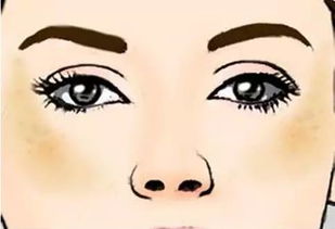 脸上妊娠斑生完孩子会消吗