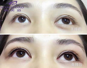 纹眼线和美瞳线的区别图片