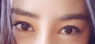 眼窝深陷怎么恢复正常