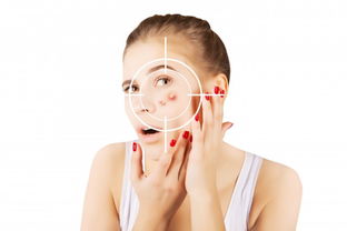 祛痘痘的小窍门