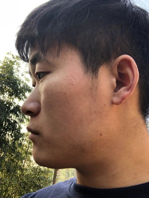 山根低怎么补救 风水