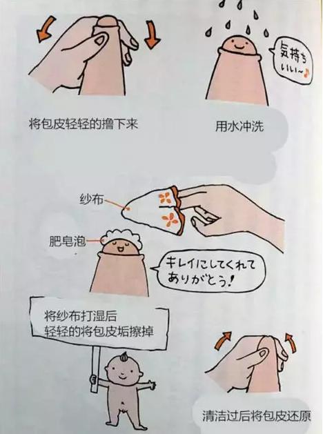 割完包皮后应该注意什么