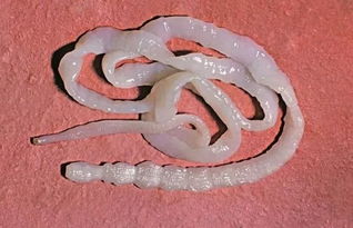 猫绦虫会传染给人吗