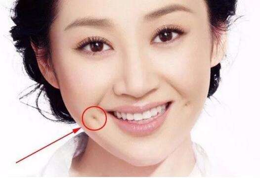 酒窝和梨涡的区别,哪个面相要更好些呢?
