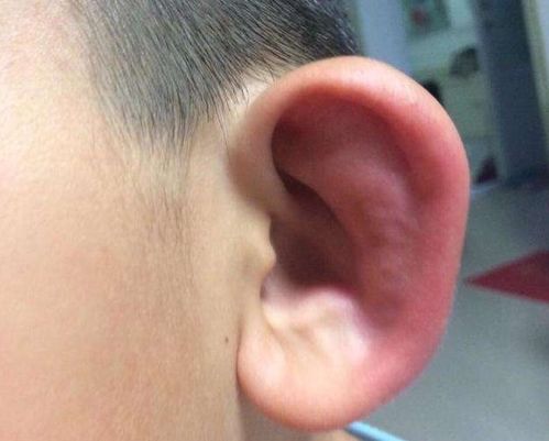 耳朵烫是有人想还是有人骂,耳朵烫烫的红红的怎么回事_竞价网