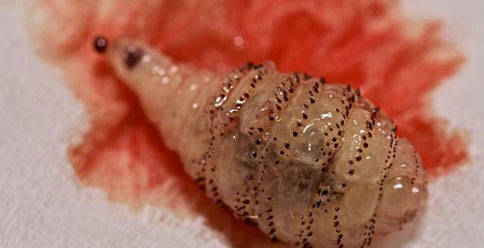 虫牙实际上并不是牙齿里面真的长了虫子,而是由于口腔不清洁,食物残渣