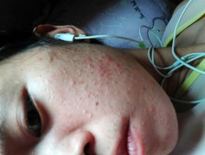 疮什么意思?近义词和反义词是什么?英文翻译是什么?